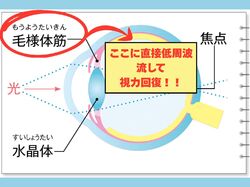 眼(視力、眼精疲労、ドライアイ)・あたま・小顔スッキリ♢体験してみて!クーポン各¥2,980