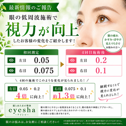 ★「眼」からくる不調に注目!眼精疲労と全身不調にアプローチする低周波治療/慢性的な不調の原因は眼?